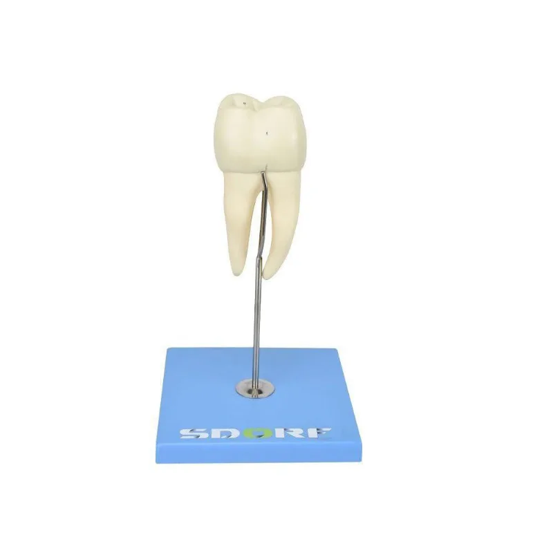 Dente Molar Inferior c/ Raiz Dupla Em 3 Partes c/ Cárie, 8x