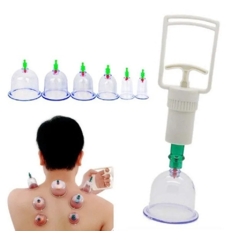 Kit Ventosas Com Bomba - 6 Copos Para Ventosaterapia