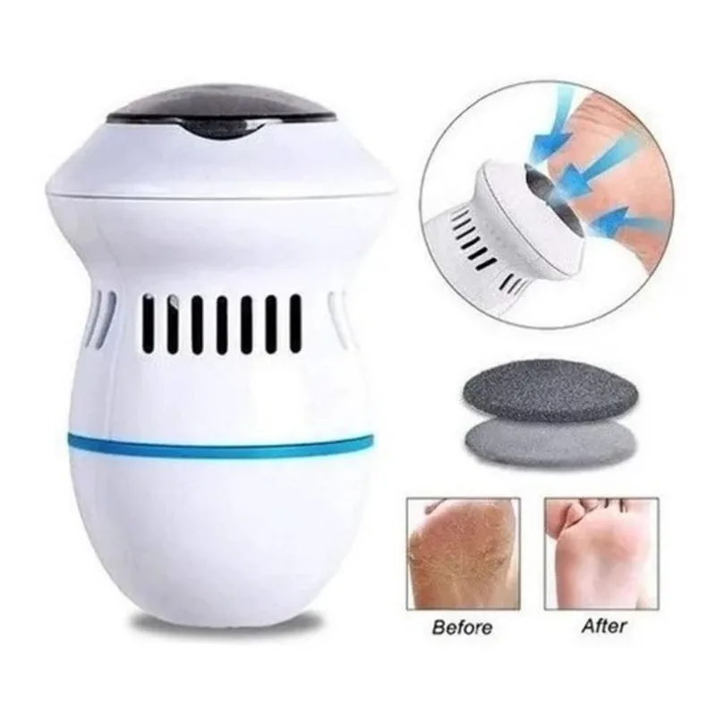 Removedor de Calos com 2 Opções de Velocidade - Ideal para Calcanhares, Solas e Dedos!