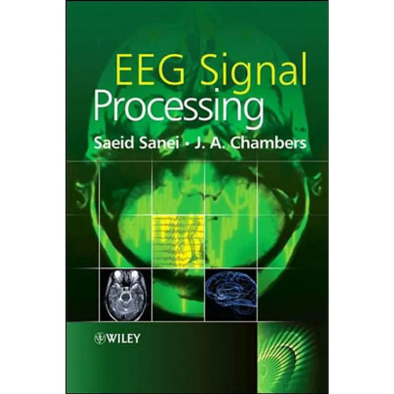 EEG SIGNAL PROCESSING