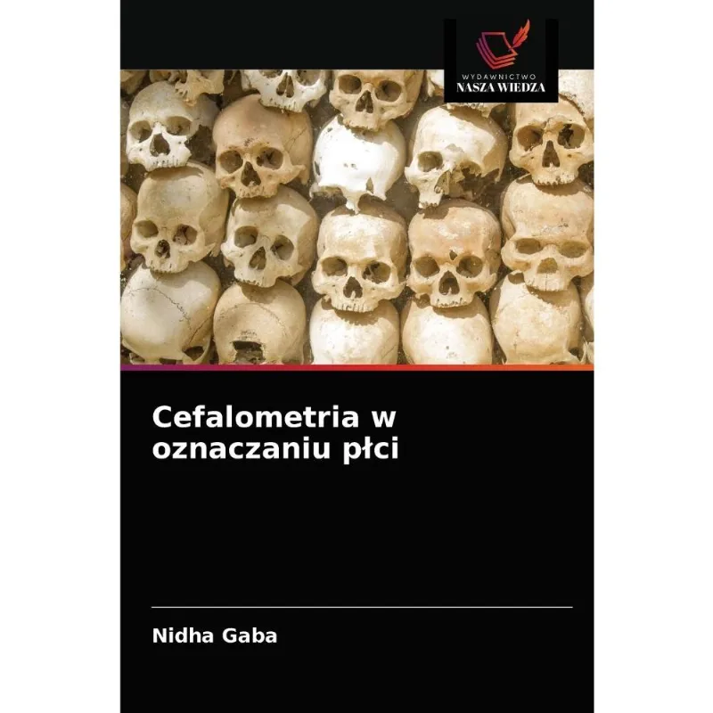 Cefalometria W Oznaczaniu Plci