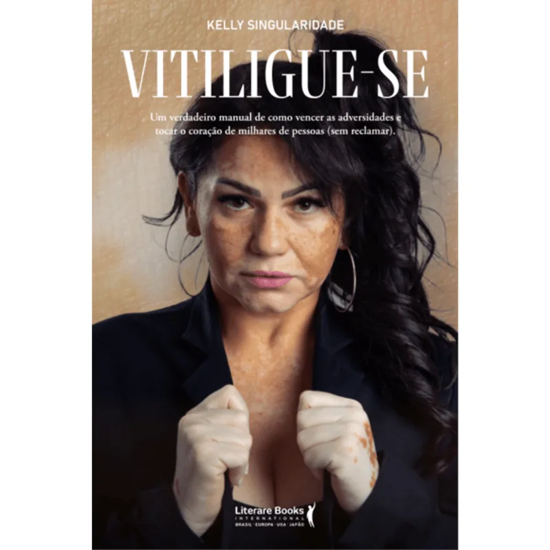 VITILIGUE-SE